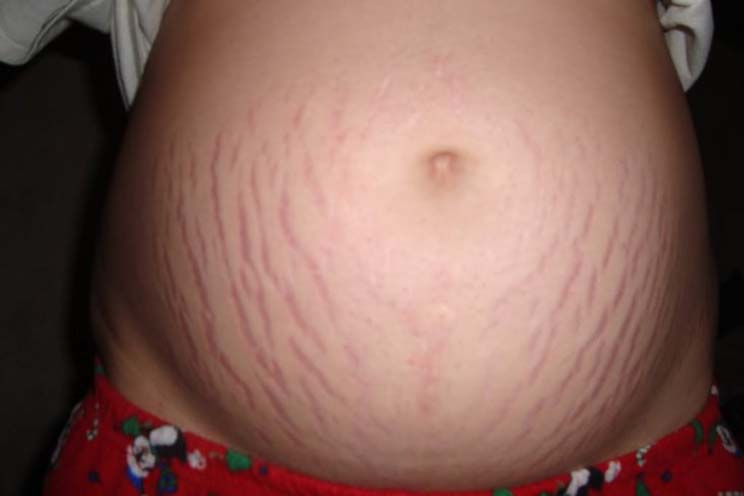 Esta mujer está embarazada desde hace 2 años y no saben cuándo dará a luz