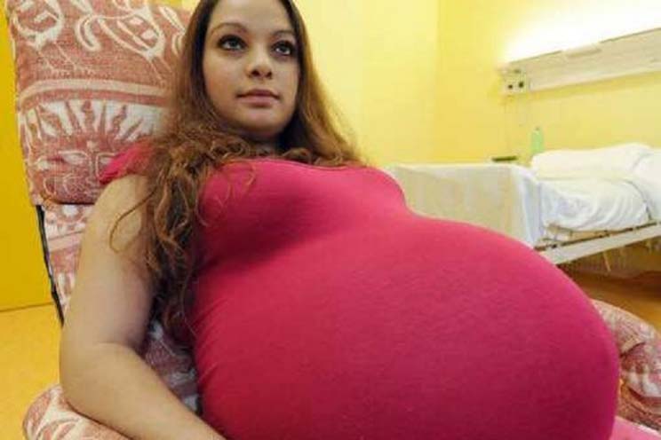 Esta mujer está embarazada desde hace 2 años y no saben cuándo dará a luz