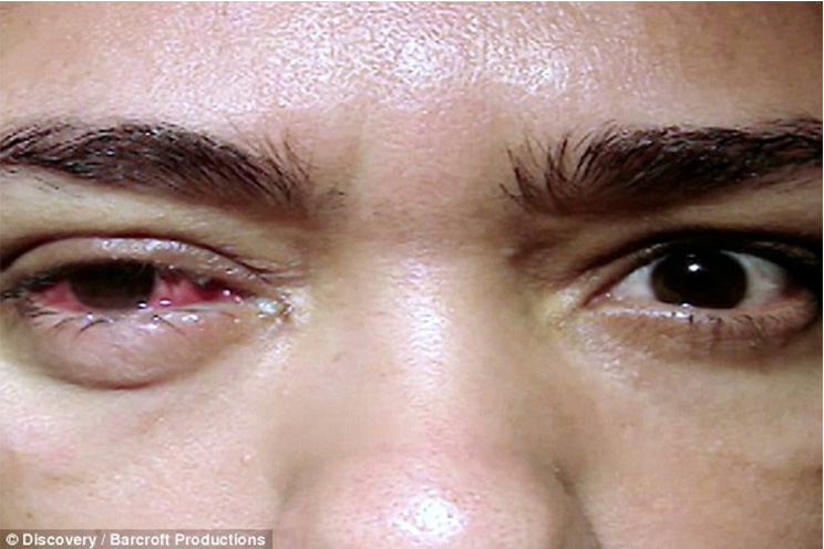 La extraña condición de la maestra que llora lágrimas de cristal