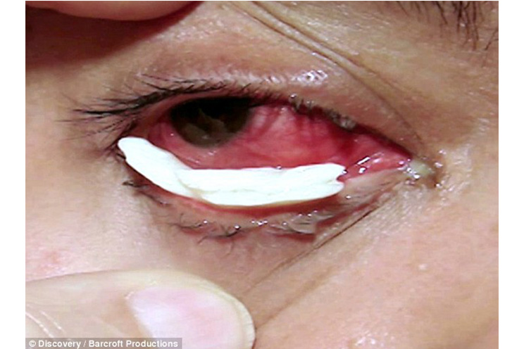 La extraña condición de la maestra que llora lágrimas de cristal