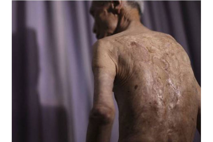 La bomba de Nagasaki marcó a un hombre de por vida