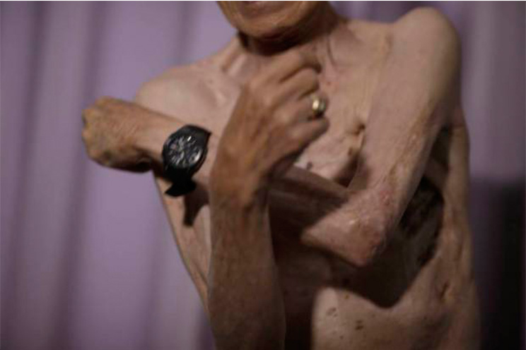 La bomba de Nagasaki marcó a un hombre de por vida