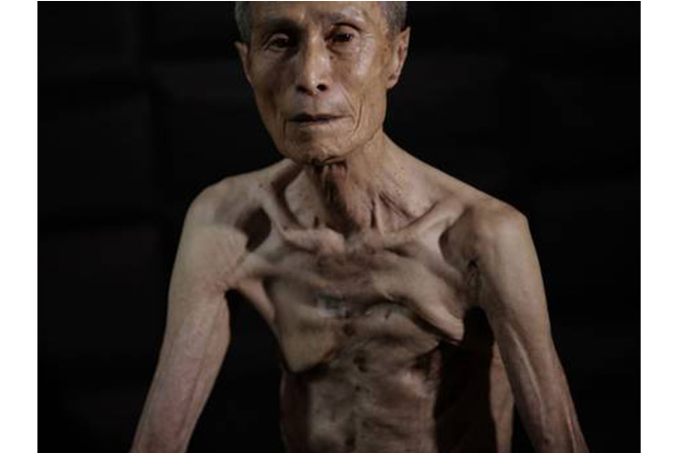 La bomba de Nagasaki marcó a un hombre de por vida