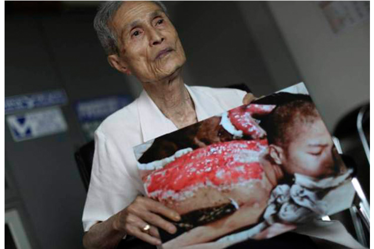 La bomba de Nagasaki marcó a un hombre de por vida