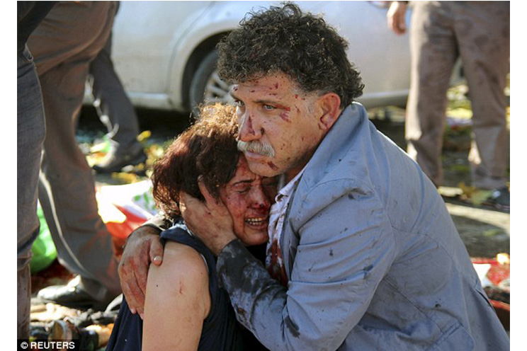 Horror en Turquía: sube a 86 cifra de muertos por ataque terrorista en Ankara (FOTOS, VIDEOS)