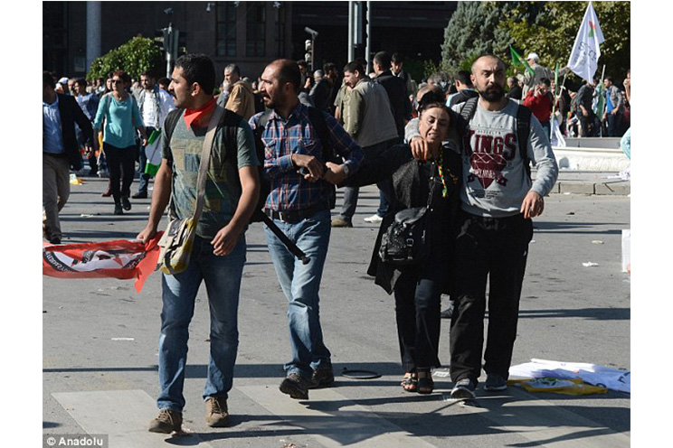 Horror en Turquía: sube a 86 cifra de muertos por ataque terrorista en Ankara (FOTOS, VIDEOS)