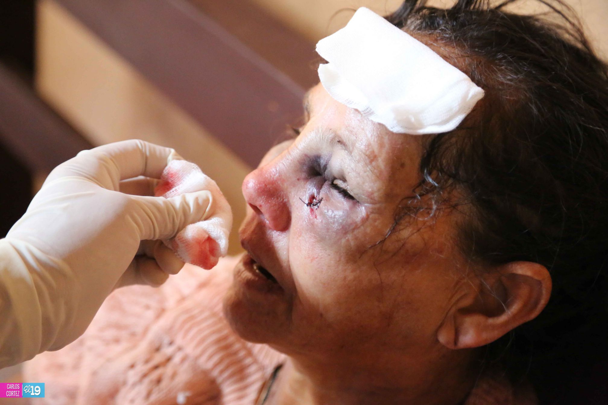 “De milagro no morimos todos”