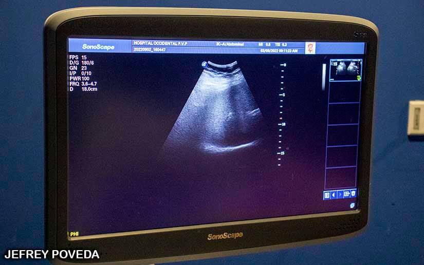 ultrasonidos