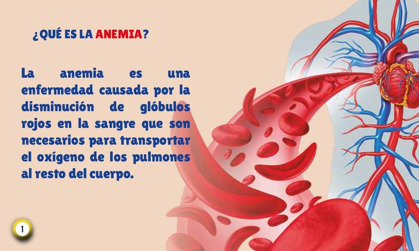 ANEMIA