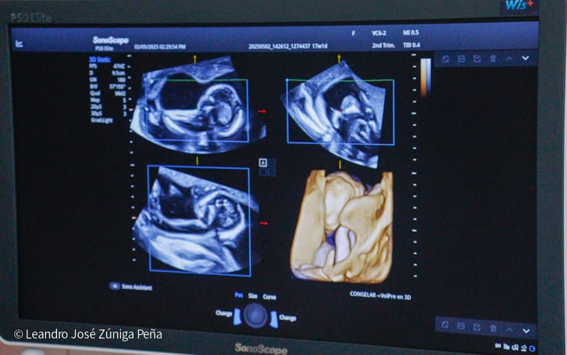 Entrega-de-Ultrasonidos-Nicaragua-17