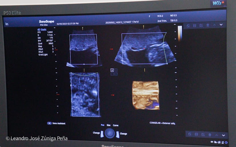 Entrega-de-Ultrasonidos-Nicaragua-4