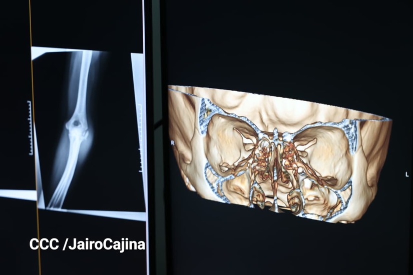 Hospital-Heroes-de-las-Segovias-46