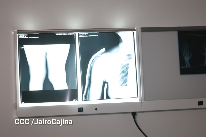 Hospital-Heroes-de-las-Segovias-68