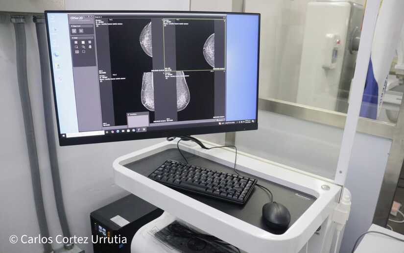 Mamografos-5